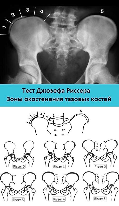 Корсеты Шено